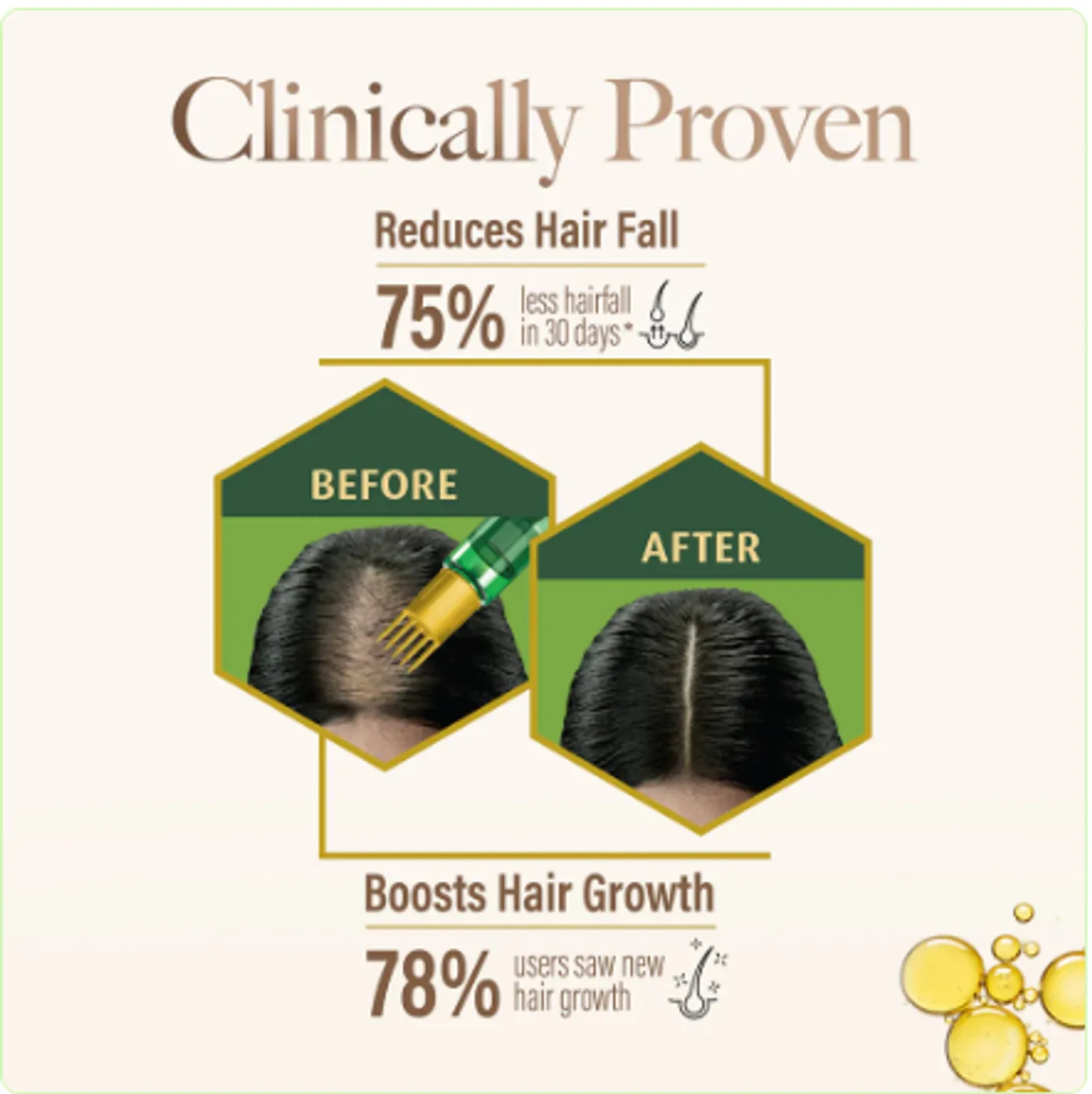 Kesh King Gold Hair Oil for Hair Growth & Hair Fall 6 Kesh King Gold Ayurvedic Hair Oil with 21 Herbs and Gro-Biotin, Helps Grow New Hair and Reduce Hair Fall, Comes with a Hairfall Reduction Tracker, 100ml 6